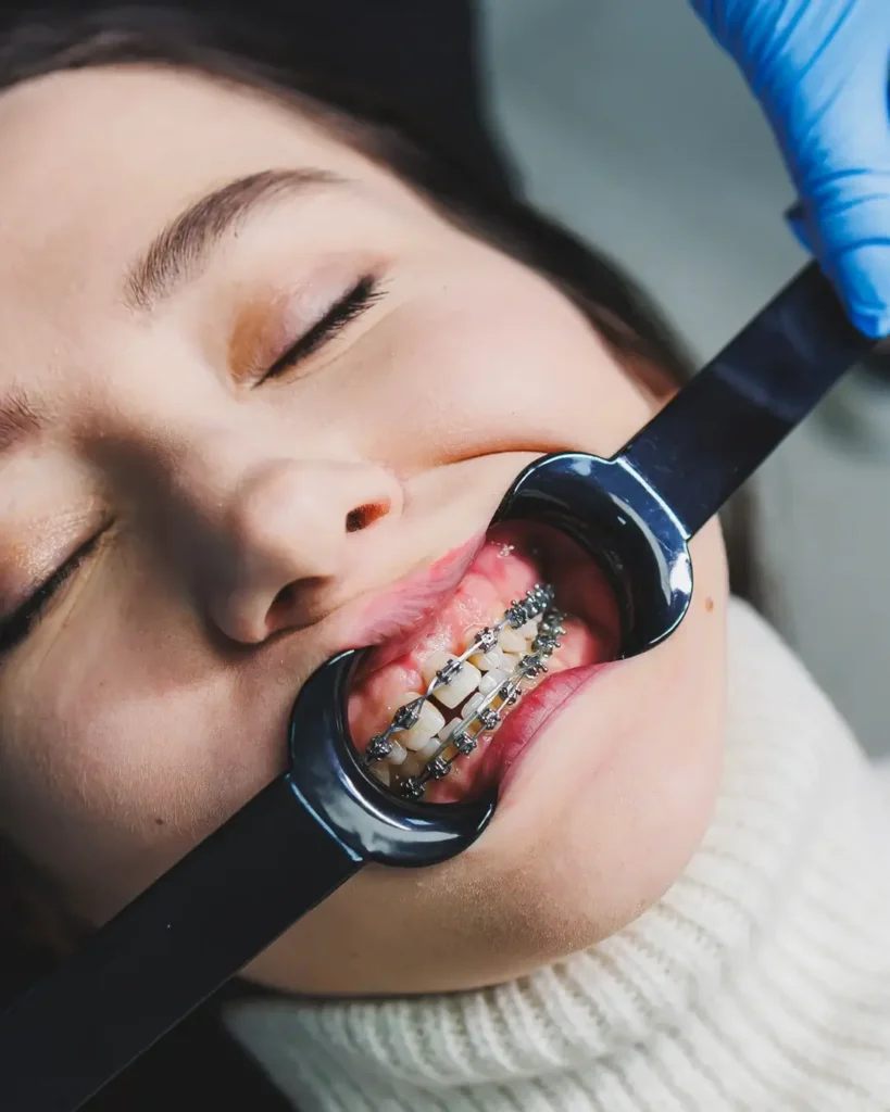 Orthodontic treatment